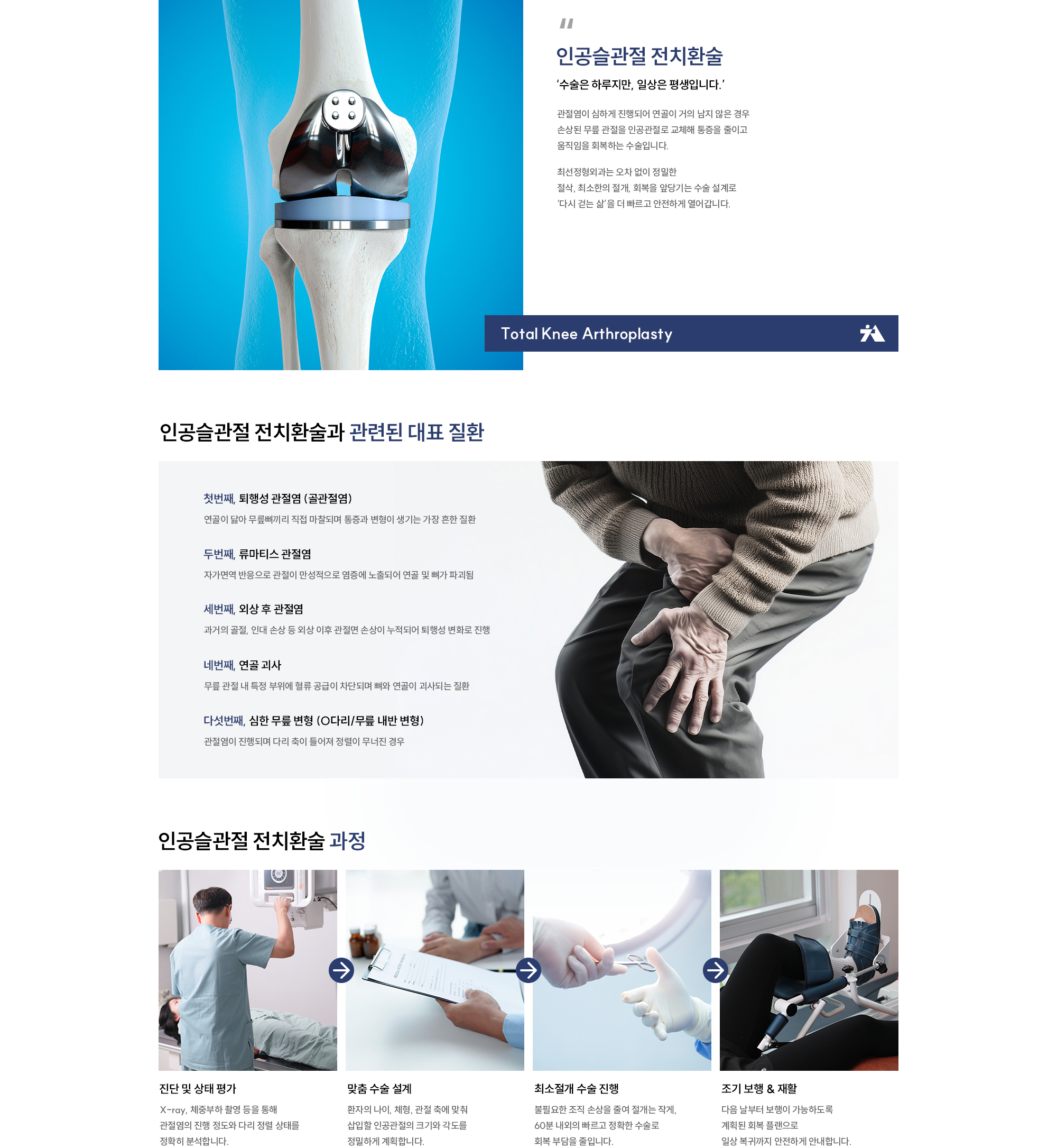 인공슬관절 전치환술
