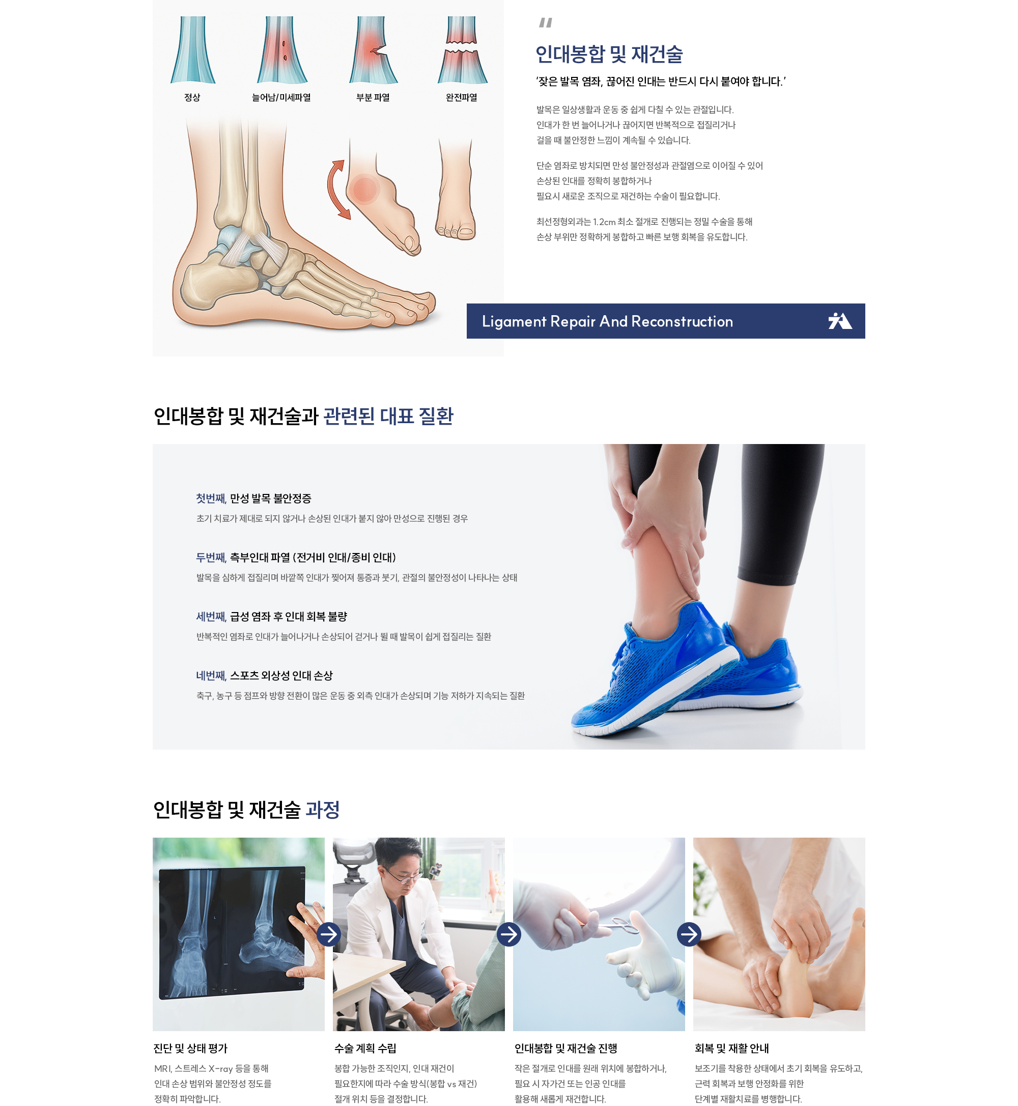 인대봉합 및 재건술